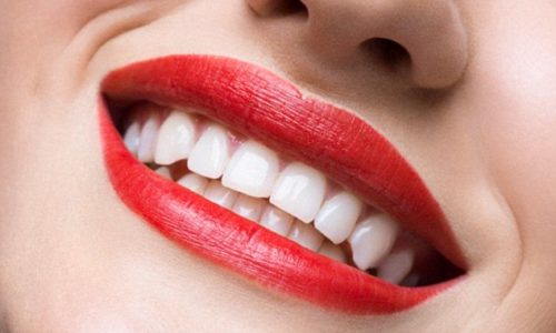 Four Dental Myths Which Are Hurting Our Teeth